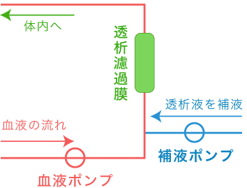 オンラインHDFの補液は透析濾過膜の前から行います。（前希釈方式）