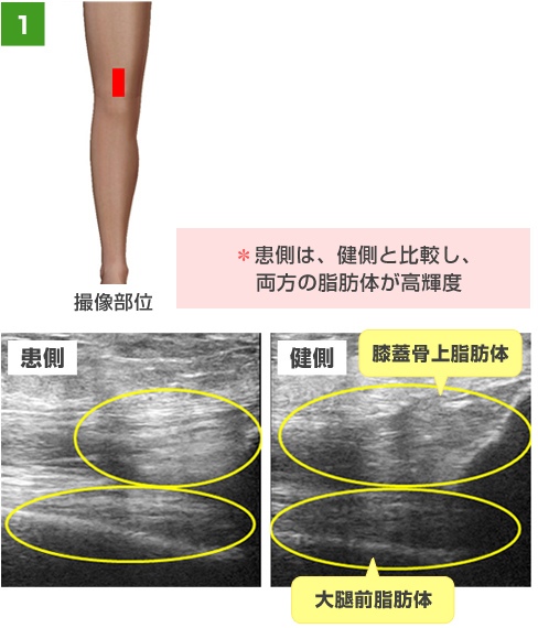 運動器エコーについて | 求人のご案内（東大阪病院 リハビリテーション